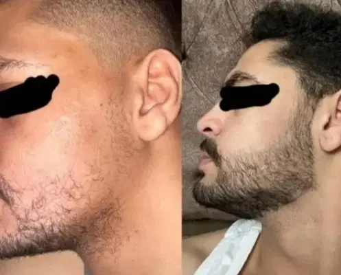مو سر و ریش|آرایشی، بهداشتی، درمانی|تهران, فردوسی|دیوار