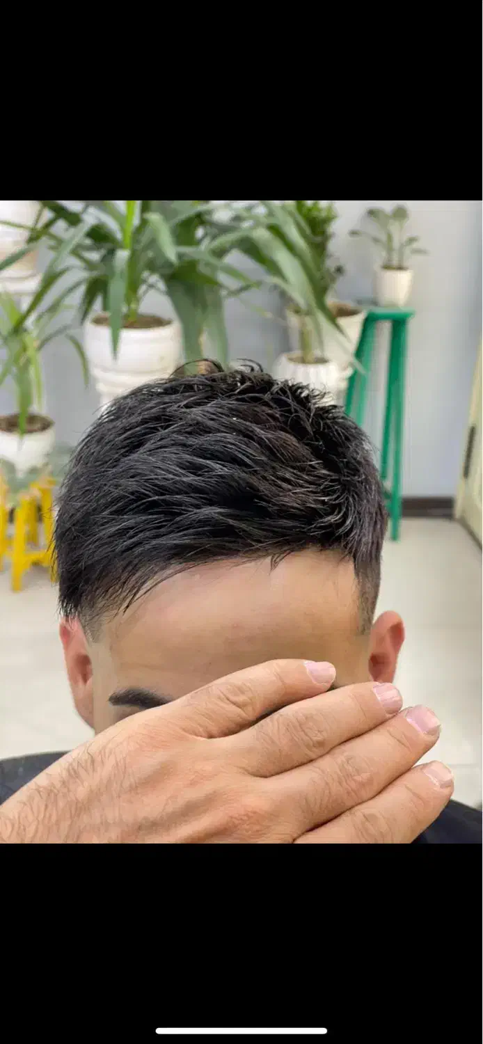 پروتز مو|آرایشی، بهداشتی، درمانی|تهران, نارمک|دیوار