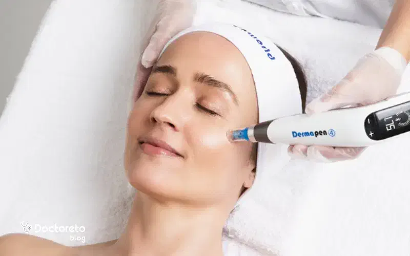 میکرونیدلینگ مزونیدلینگ مزوتراپی در منزل|خدمات آرایشگری و زیبایی|تهران, اختیاریه|دیوار