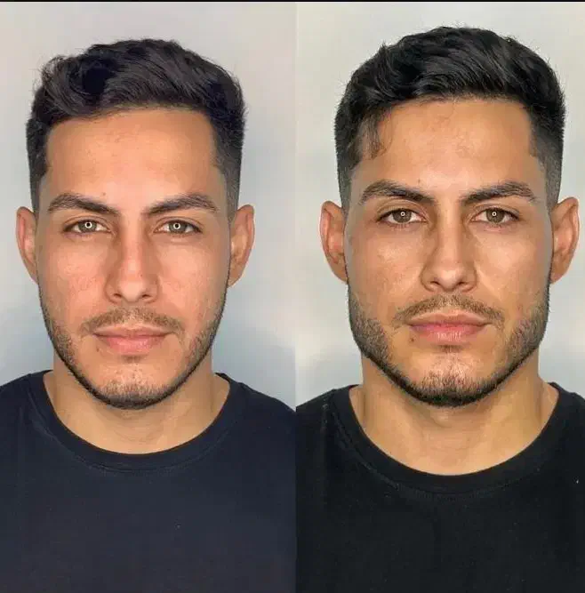 آموزش صفر تا صد زیبایی فیلر و بوتاکس و مزو تراپی|خدمات آرایشگری و زیبایی|اردبیل, |دیوار