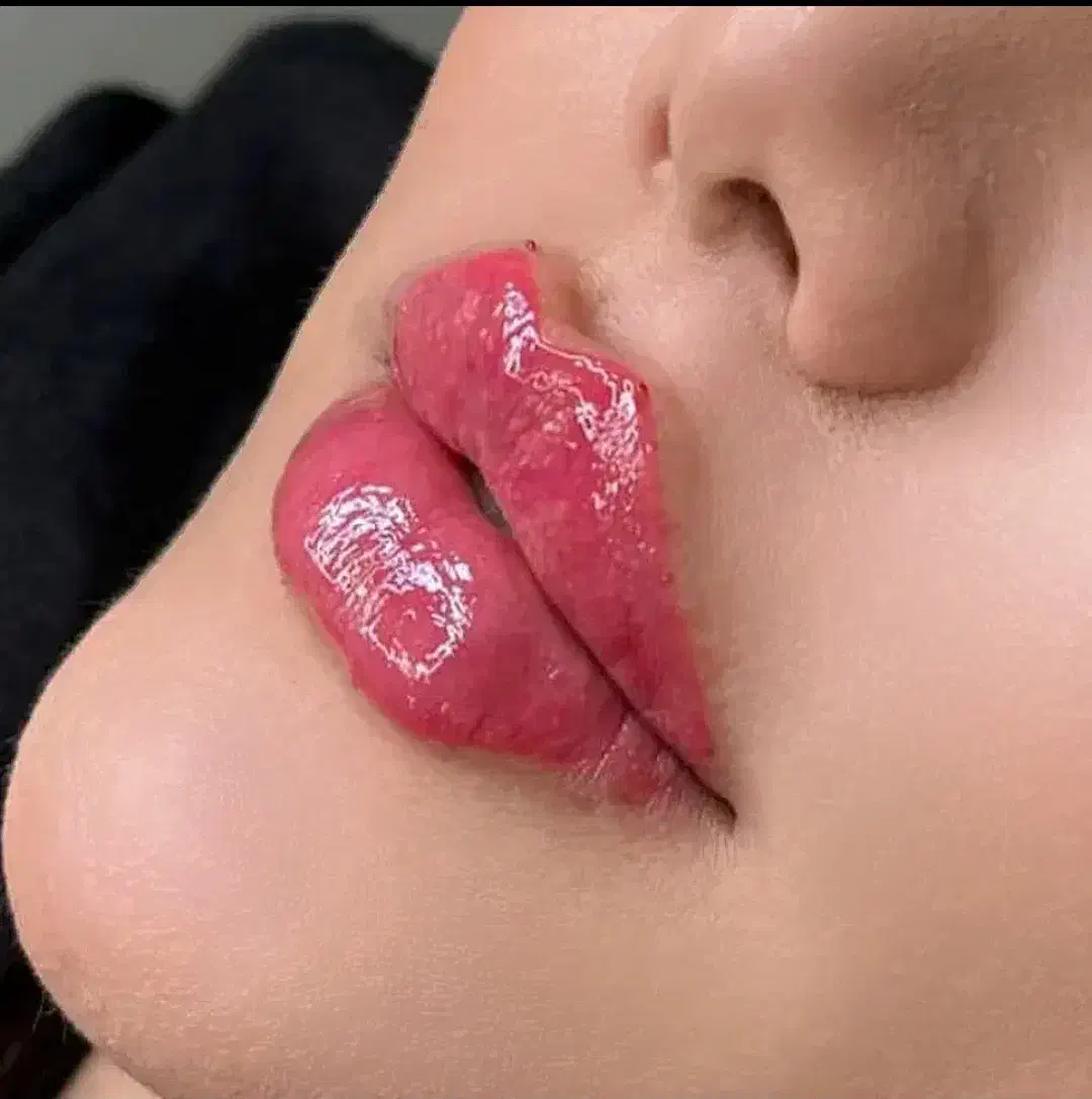 تزریق ژل و بوتاکس با مواد اصل و اورجینال|خدمات آرایشگری و زیبایی|ساری, |دیوار