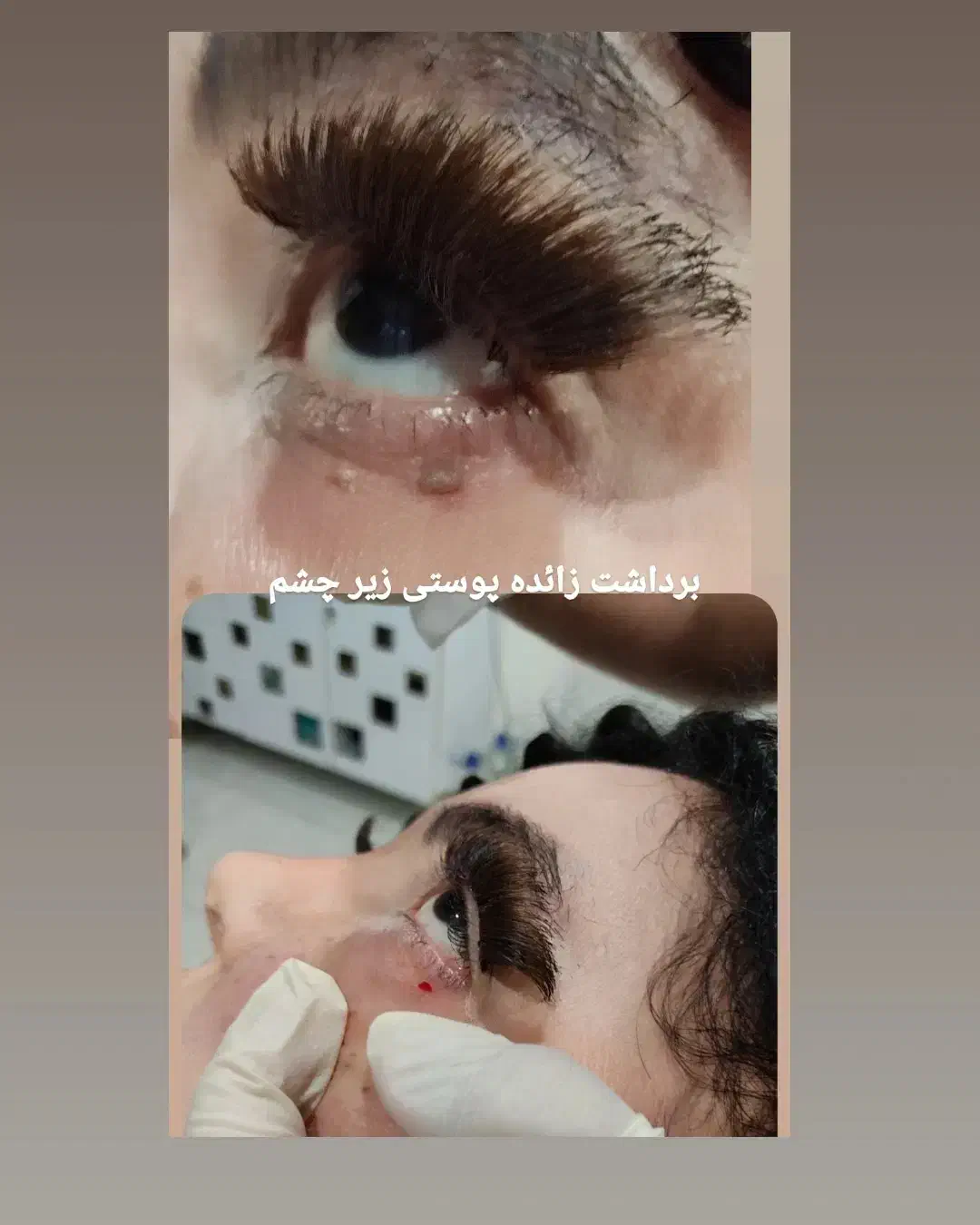 لیزر وزیبایی طلا|خدمات آرایشگری و زیبایی|سنندج, |دیوار