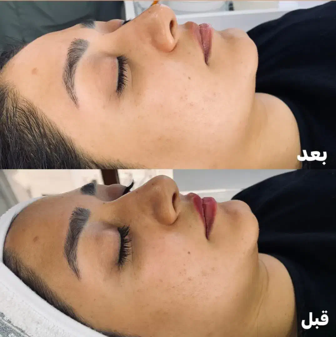 خدمات تخصصی پوست در محدوده ولیعصر|خدمات آرایشگری و زیبایی|تهران, بلوار کشاورز|دیوار