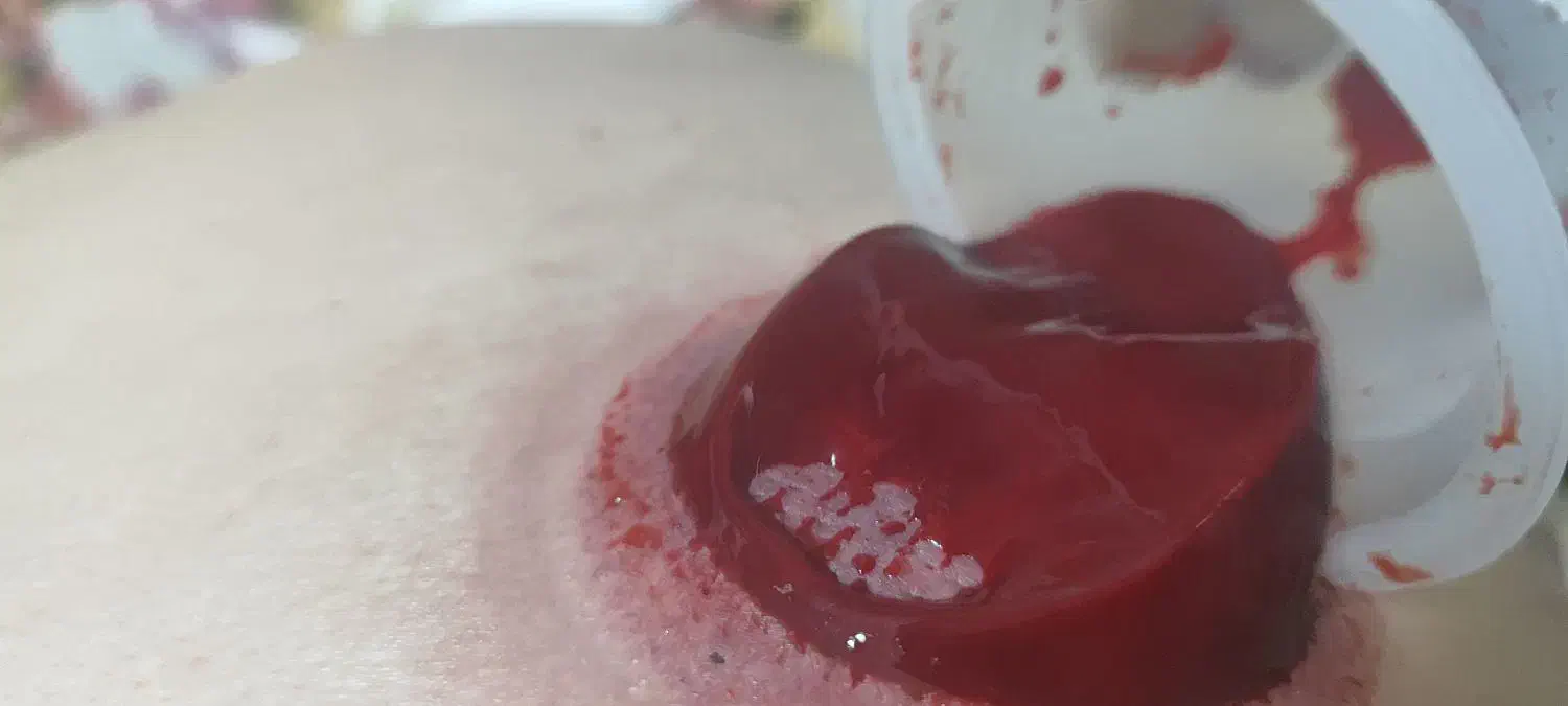 حجامت بادکش.طب سنتی برداشت خال وبا پزشک|خدمات آرایشگری و زیبایی|شیراز, دشت چنار|دیوار