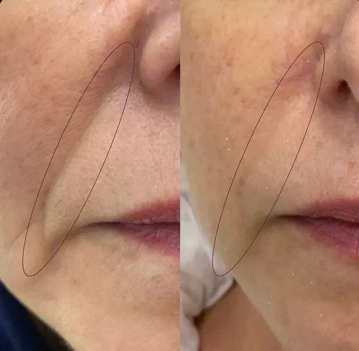 جوانسازی بسیار قوی ، برند اسپانیا ،|آرایشی، بهداشتی، درمانی|ری, امین آباد|دیوار