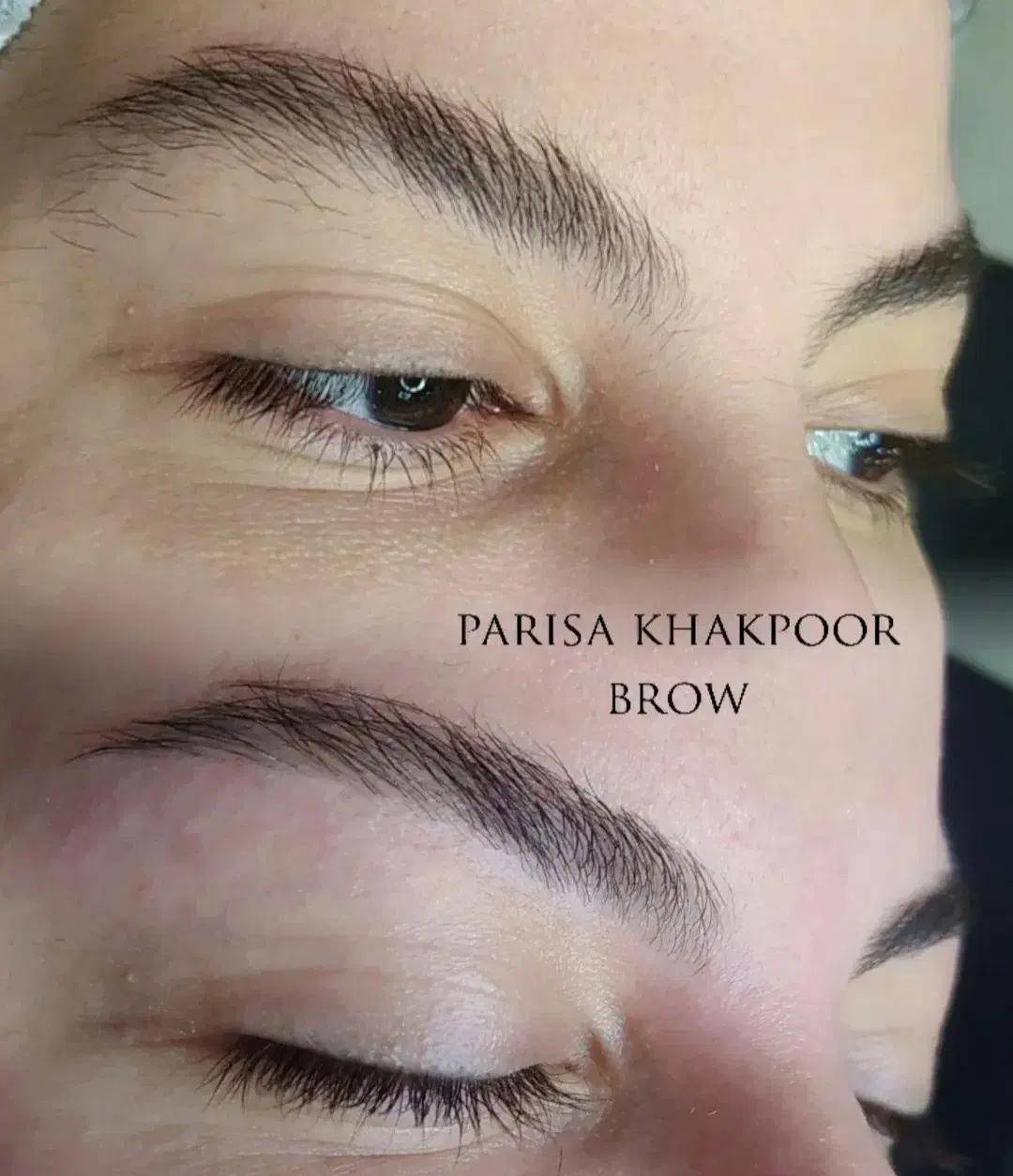 اصلاح درماپلینگ.اصلاح باوکس. اصلاح با بخار.|خدمات آرایشگری و زیبایی|اردکان, |دیوار