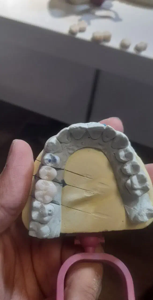 دندانسازی تاکستان|پزشکی|تاکستان, |دیوار