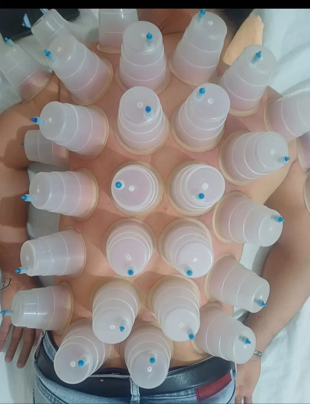 حجامت معجزه میکنه|آرایشی، بهداشتی، درمانی|بندر کنگان, |دیوار