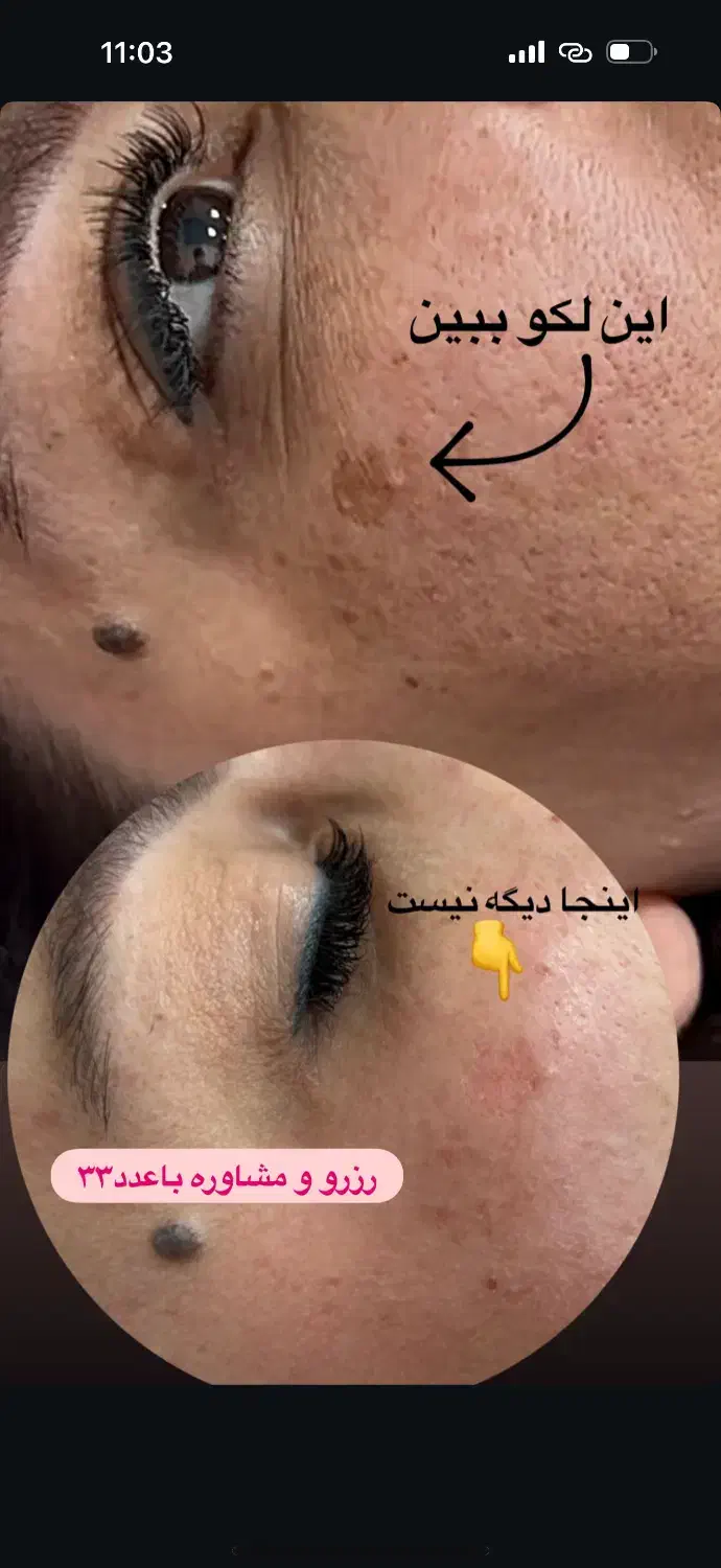 ریمولک تک جلسه ایی|خدمات آرایشگری و زیبایی|سرپل ذهاب, |دیوار