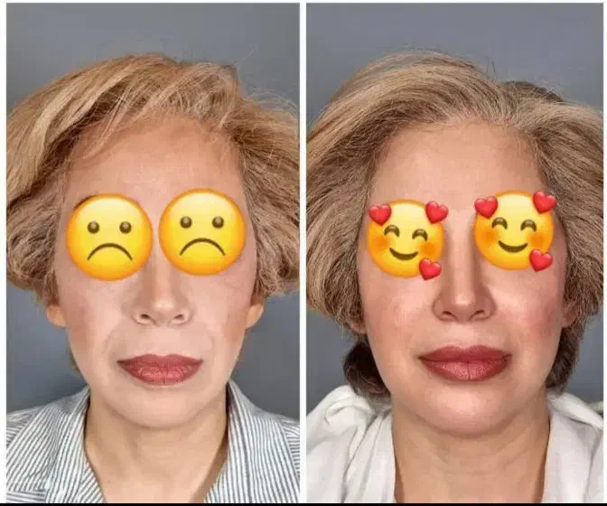 پکیج  چاقی صورت و جوانسازی|خوردنی و آشامیدنی|اهواز, طالقانی|دیوار