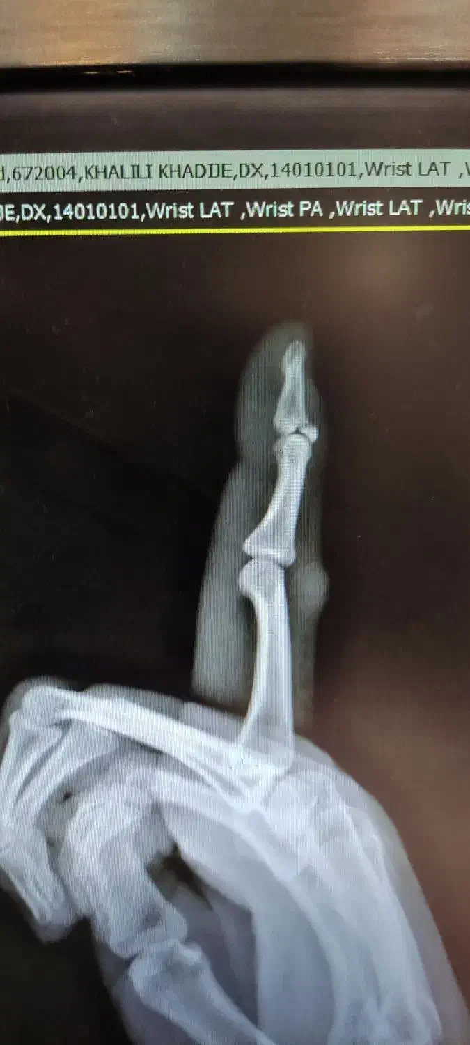 مراقبت از بیمار|استخدام درمانی، زیبایی، بهداشتی|رشت, معلم|دیوار