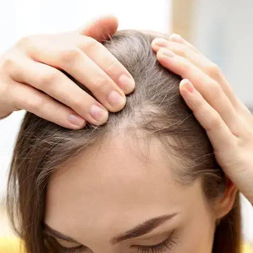 رفع ریشه ای ریزش مو و ریش|آرایشی، بهداشتی، درمانی|اهواز, اهواز|دیوار