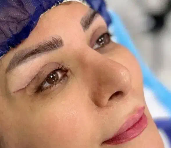 ارائه انواع خدمات زیبای درمطب توسط پزشک|خدمات آرایشگری و زیبایی|قم, امامزاده ابراهیم|دیوار