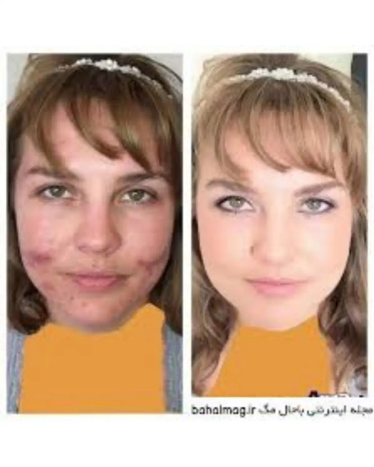 vip|آرایشی، بهداشتی، درمانی|چابهار, |دیوار