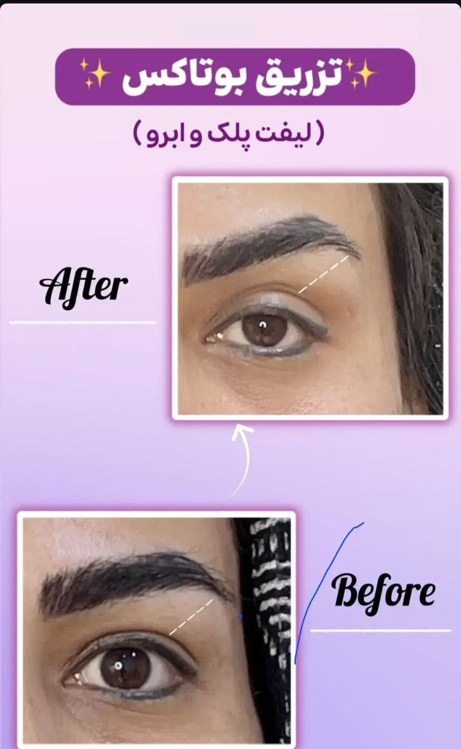 انجام خدمات زیبایی|خدمات آرایشگری و زیبایی|کرمان, |دیوار