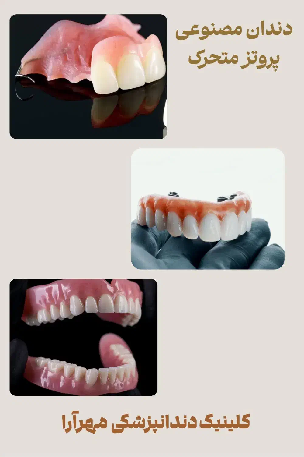 دندان مصنوعی|خدمات آرایشگری و زیبایی|خرمشهر, |دیوار