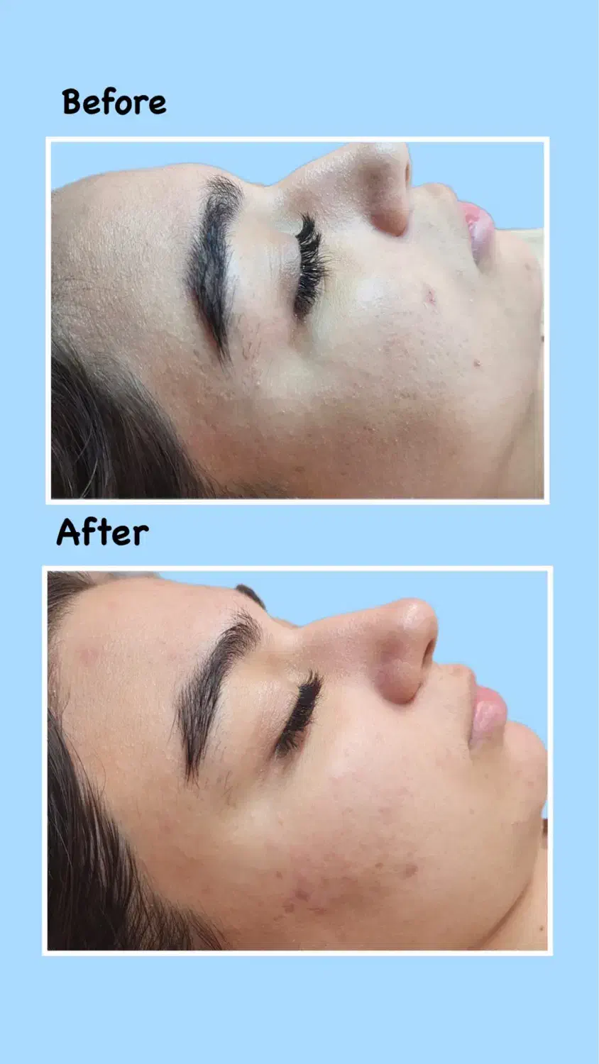 فیشیال ،آبرسانی|خدمات آرایشگری و زیبایی|تهران, فاطمی|دیوار