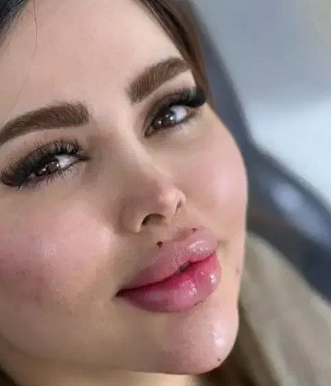 ژل و چربی|خدمات آرایشگری و زیبایی|ایلام, |دیوار