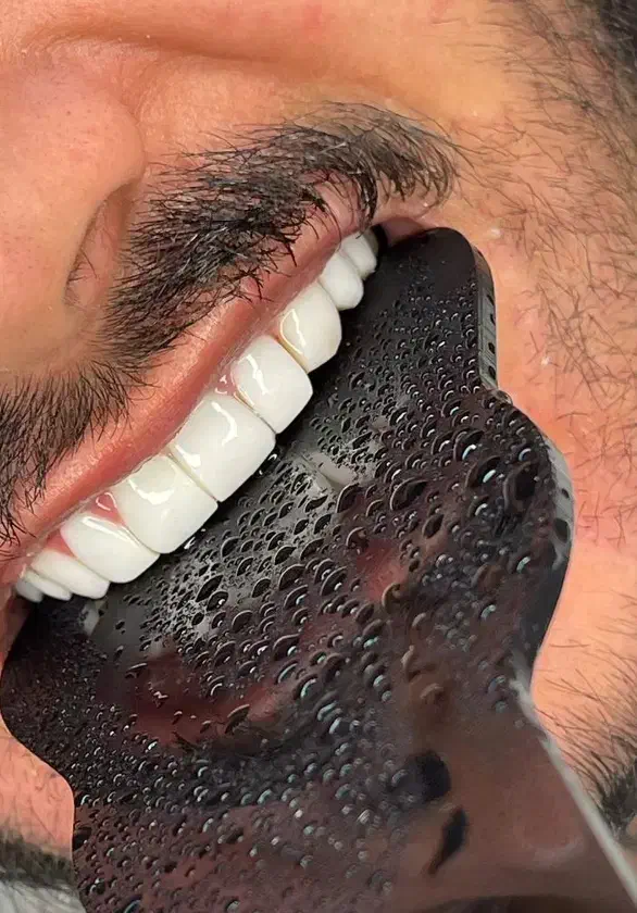 کامپوزیت/لمینیت/عصب کشی/روکش طلا|خدمات آرایشگری و زیبایی|تهران, دردشت|دیوار