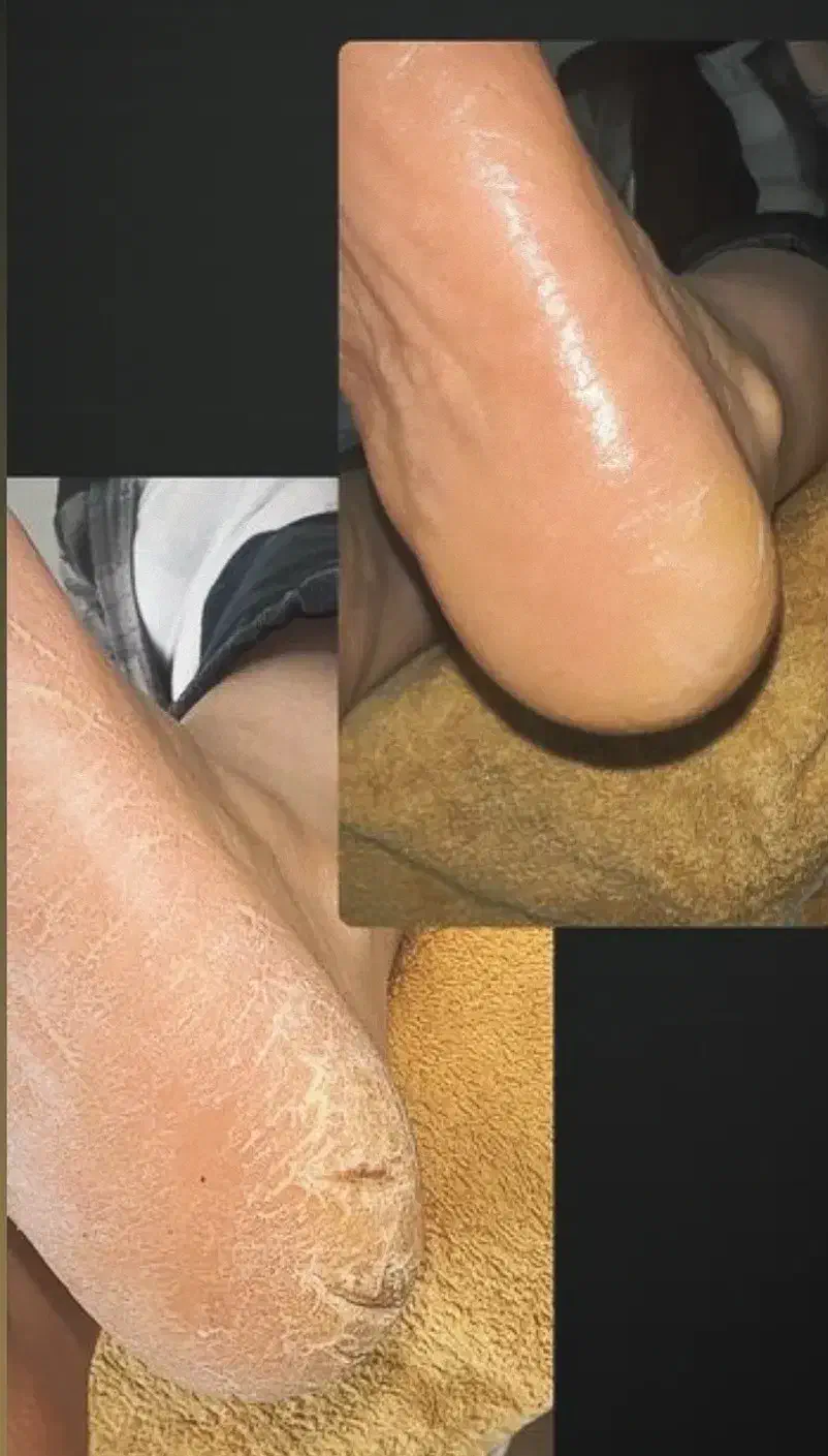 پدیکور و کف سابی کف پا|خدمات آرایشگری و زیبایی|آمل, |دیوار