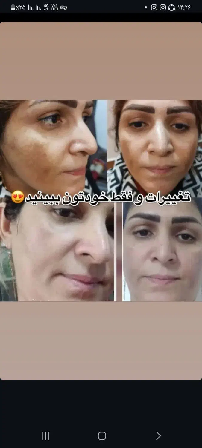 کرم معجزه شب|آرایشی، بهداشتی، درمانی|بندر گز, |دیوار