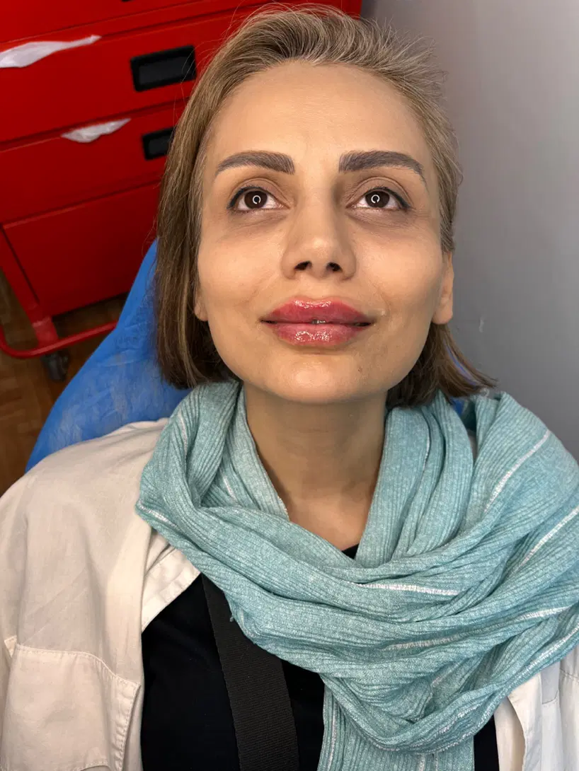 تزریق فیلر بوتاکس ،شرایط اقساط،اسنپ پی،ونک|خدمات زیبایی و سلامت|تهران, ونک|دیوار