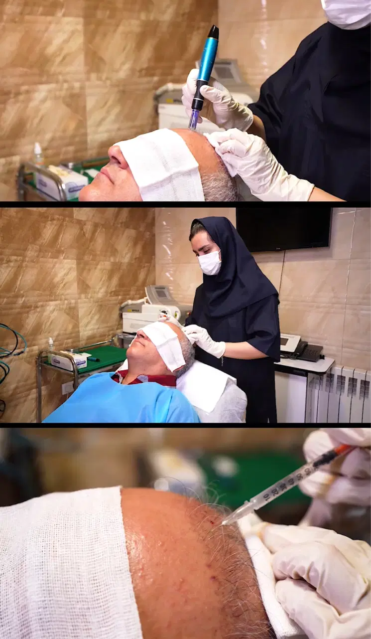 پی آرپی و مزوتراپی در اصفهان کلینیک آفتاب|خدمات زیبایی و سلامت|اصفهان, رکن الدوله غربی|دیوار