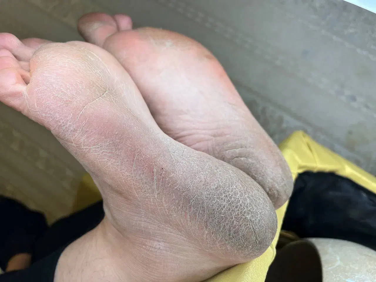 پدیکور تخصصی و درمانی|خدمات آرایشگری و زیبایی|باسمنج, |دیوار