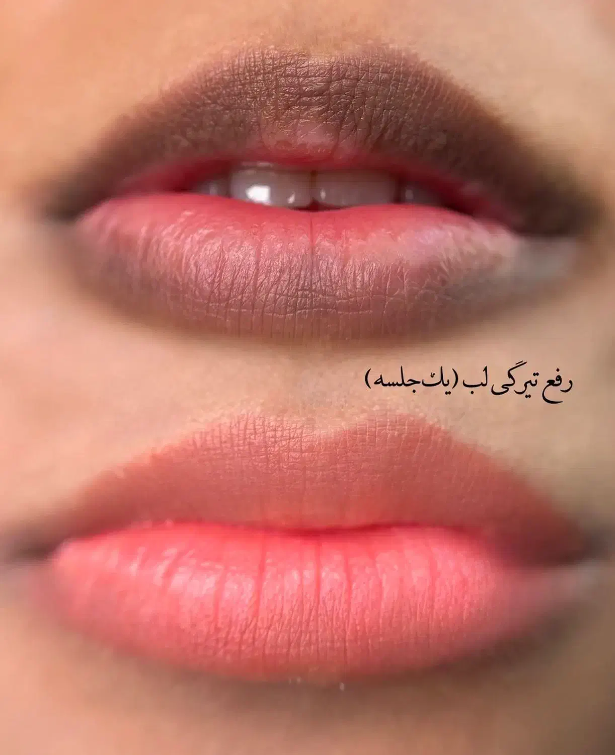 شید ینگ لب تخفیف ویژه|خدمات آرایشگری و زیبایی|ساری, |دیوار