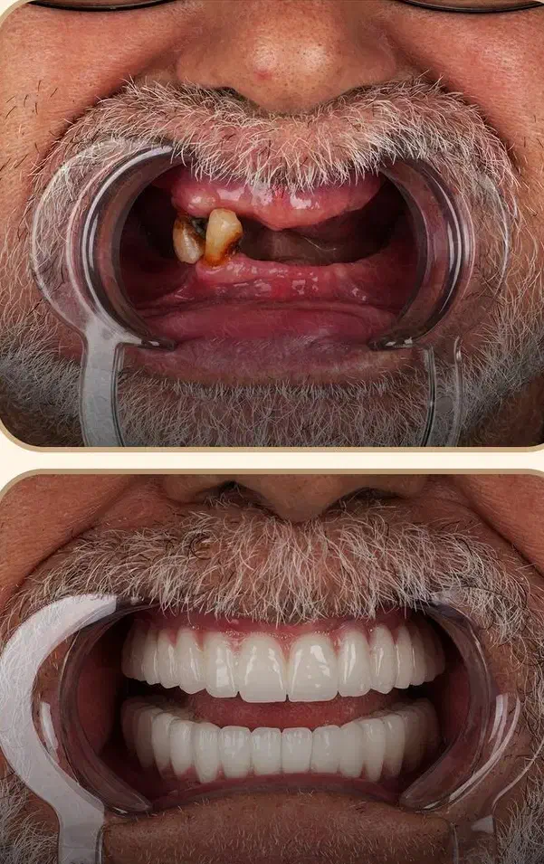 کلینیک تخصصی ایمپلنت دیجیتال آرمو|خدمات آرایشگری و زیبایی|شیراز, فرهنگ شهر|دیوار