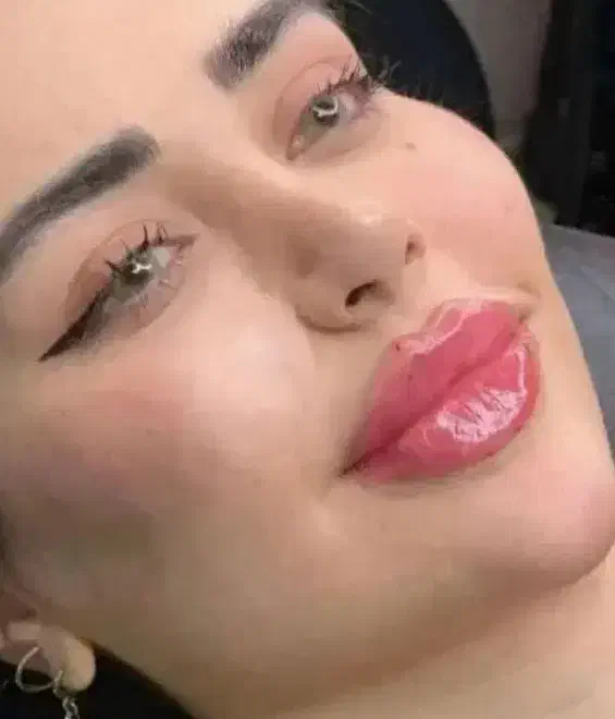 آفر ویژه خدمات زیبایی ژل فیلر بوتاکس لیفت|خدمات آرایشگری و زیبایی|شاهینشهر, طالقانی|دیوار