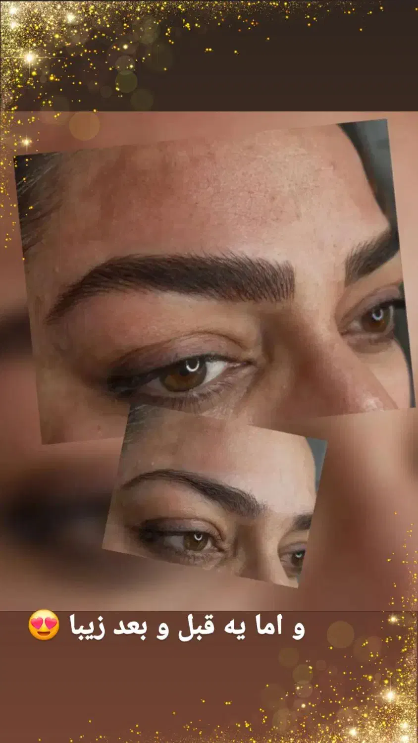 میکروبلیدینگ،روشن سازی تتو تیره بدون نیازبه ریموو|خدمات آرایشگری و زیبایی|بندرعباس, |دیوار