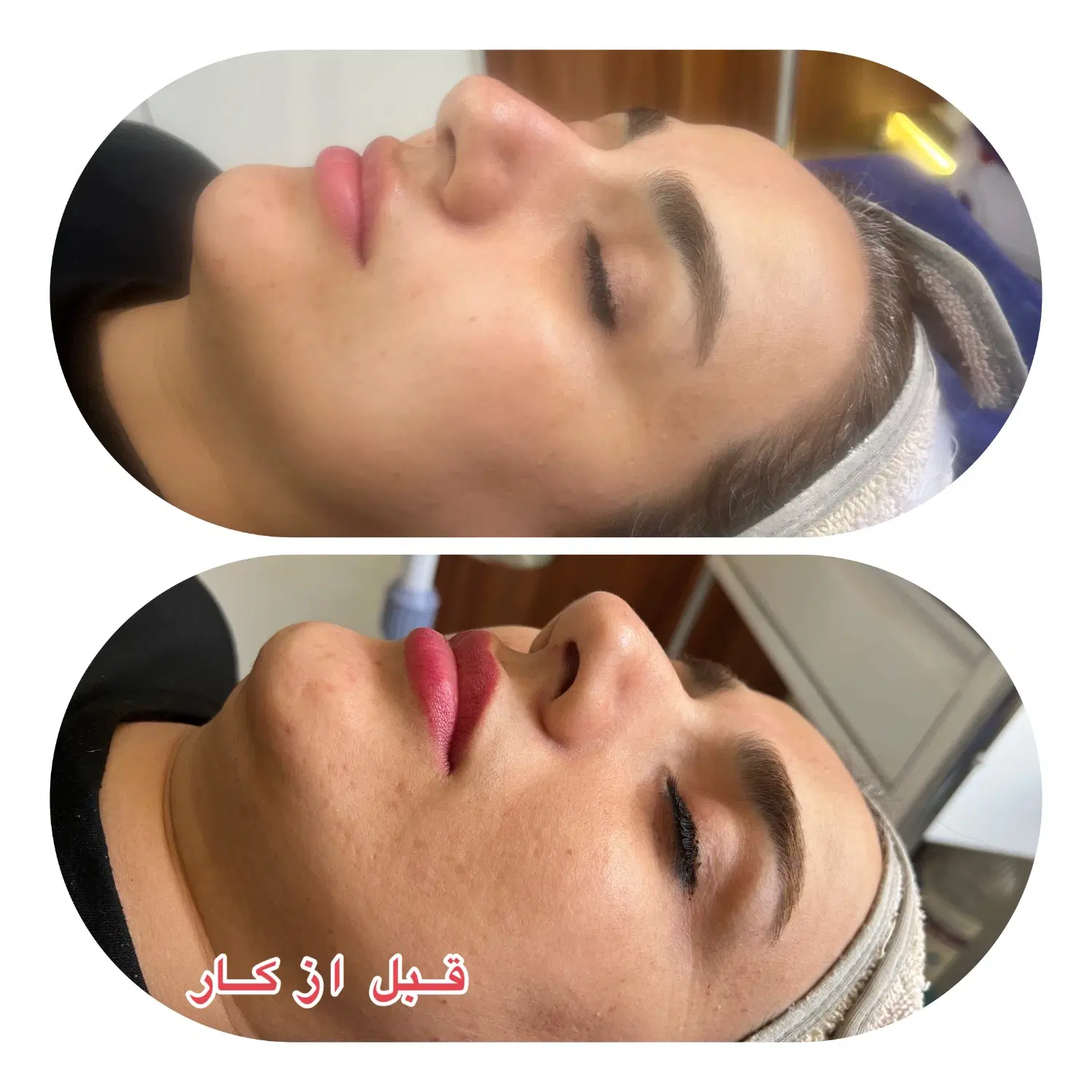 پیکر تراشی لیپو ابدو و بلفاری|خدمات زیبایی و سلامت|تهران, تهرانپارس غربی|دیوار