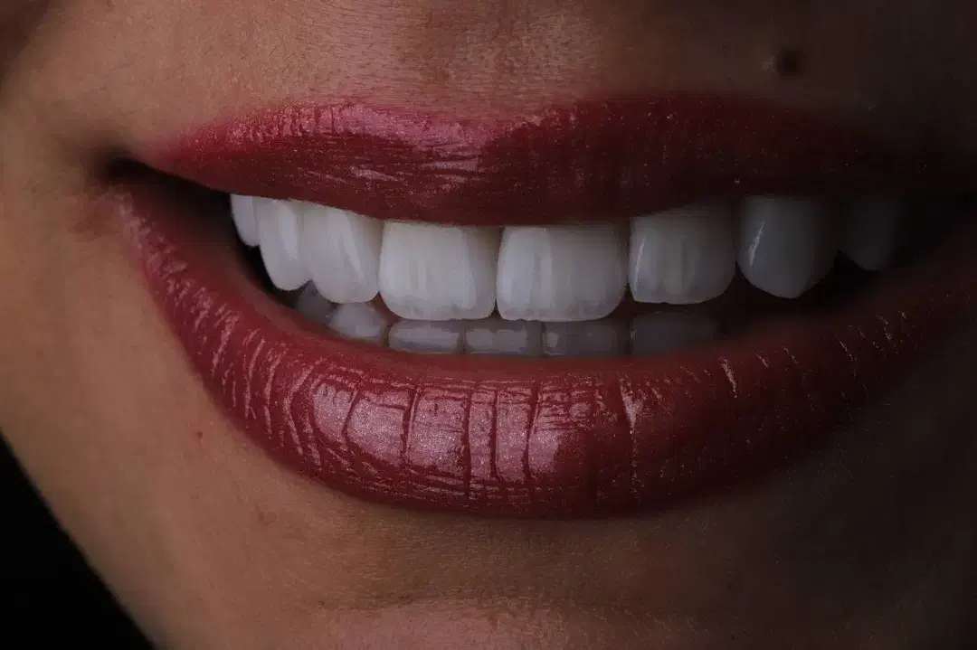 دستیار دندانپزشکی|استخدام درمانی، زیبایی، بهداشتی|قدس, شهرقدس|دیوار