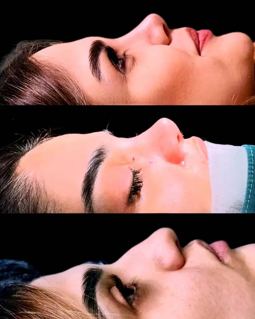 عمل جراحی بینی با ۵۰٪تخفیف ویژه فرصت محدود|خدمات آرایشگری و زیبایی|اصفهان, نقش جهان|دیوار