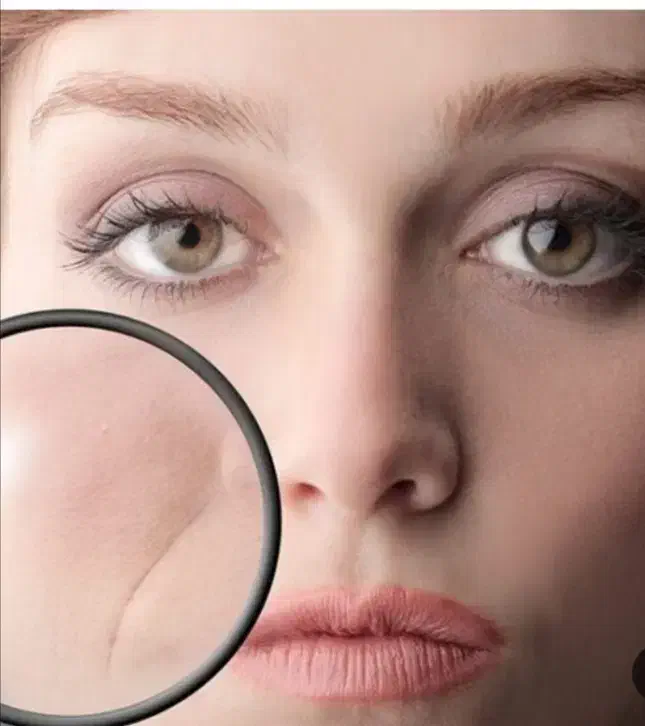 تزریق فیلر|خدمات آرایشگری و زیبایی|دورود, |دیوار