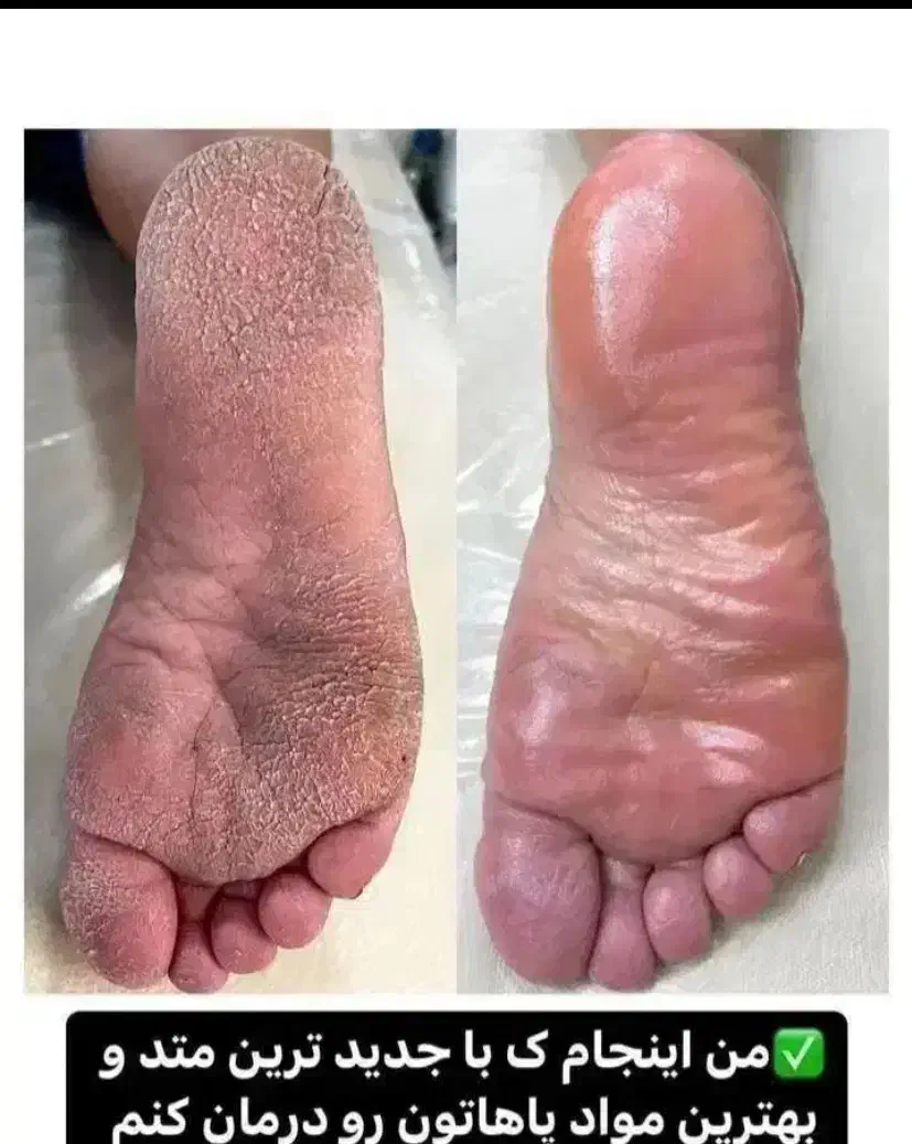 اف تمامی خدمات سالن زیبایی باپرسنل حرفه ای|آرایشگاه و سالن‌های زیبایی|دورود, |دیوار