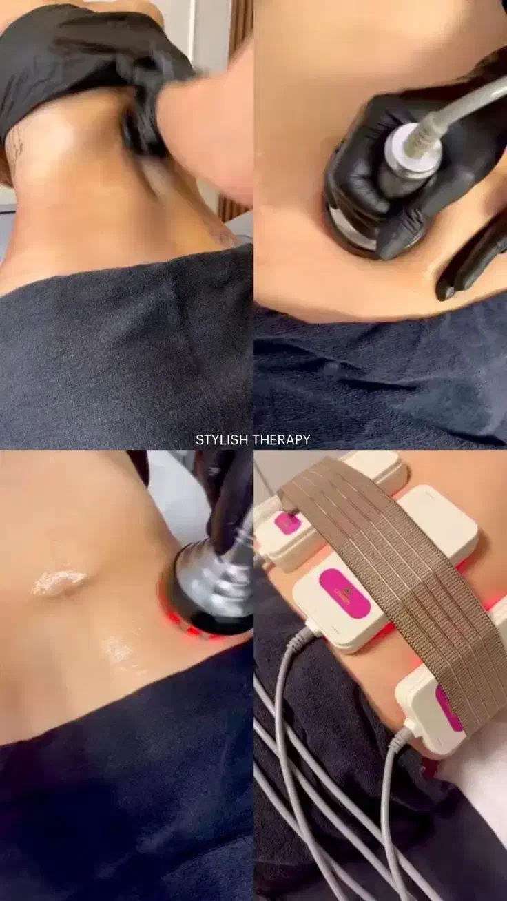 لاغری بدون جراحی با دستگاه کرایولیپولیز|خدمات آرایشگری و زیبایی|گرگان, |دیوار