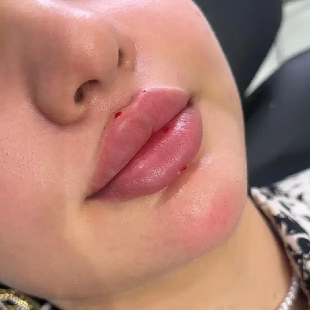 خدمات فیلروبوتاکس|خدمات آرایشگری و زیبایی|سنندج, |دیوار