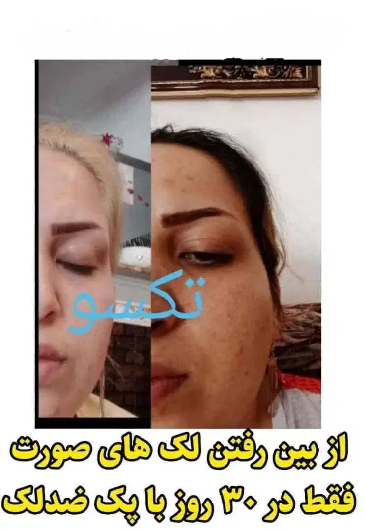 با ما بدرخشید واز شرلک هات خلاص شو|خدمات آرایشگری و زیبایی|باشت, |دیوار