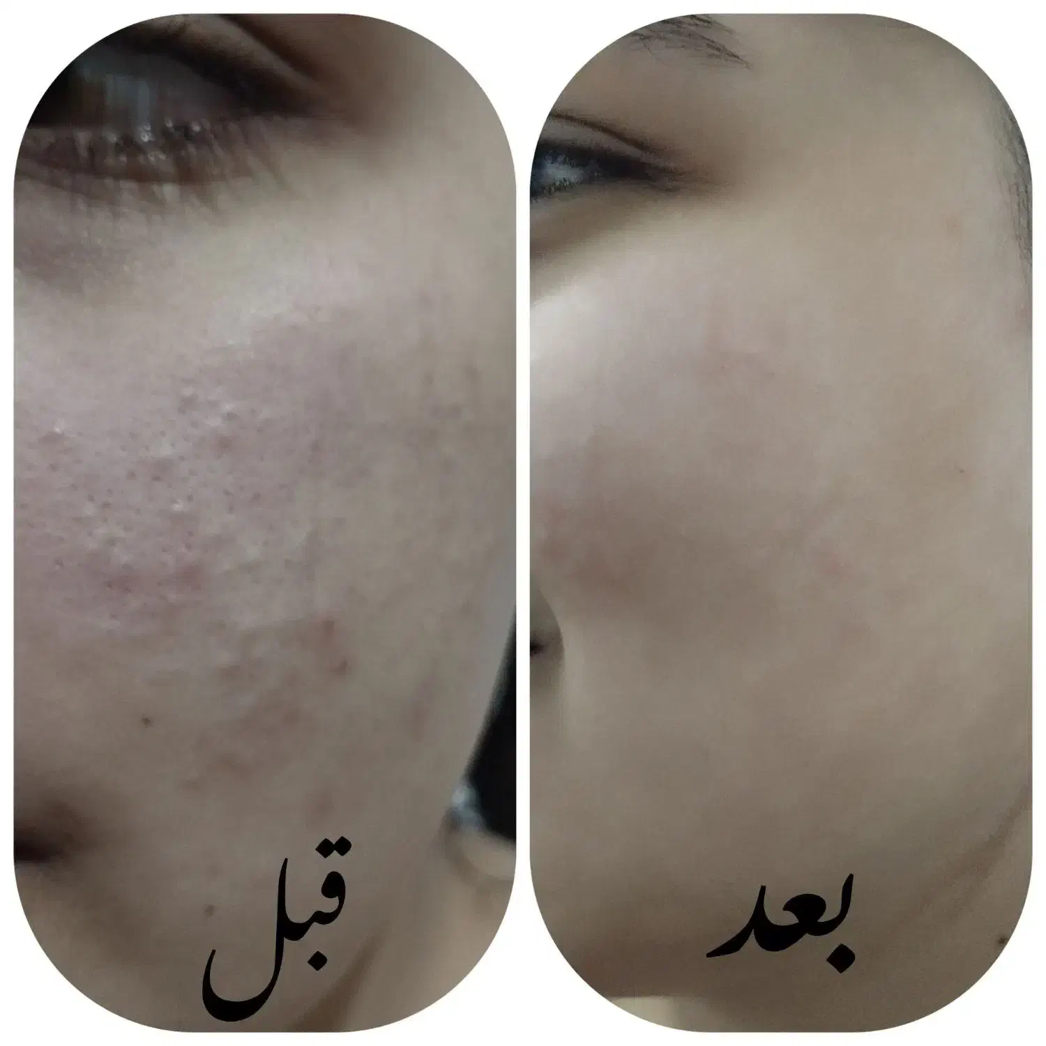 انواع سرم|آرایشی، بهداشتی، درمانی|شیراز, باجگاه|دیوار