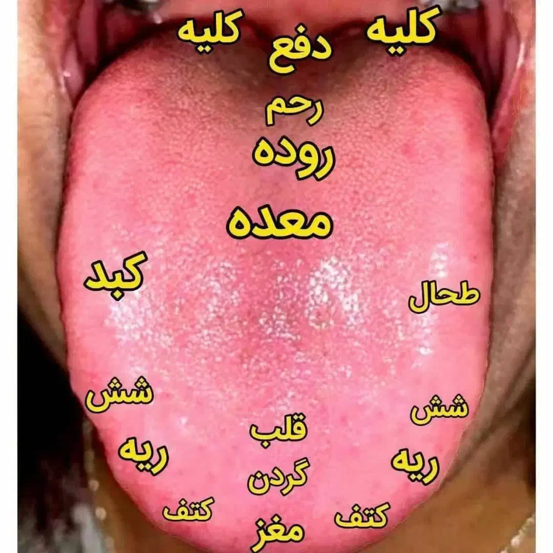 تشخیص ودرمان بیماری ها از روی عکس زبان|خدمات آرایشگری و زیبایی|امیدیه, |دیوار