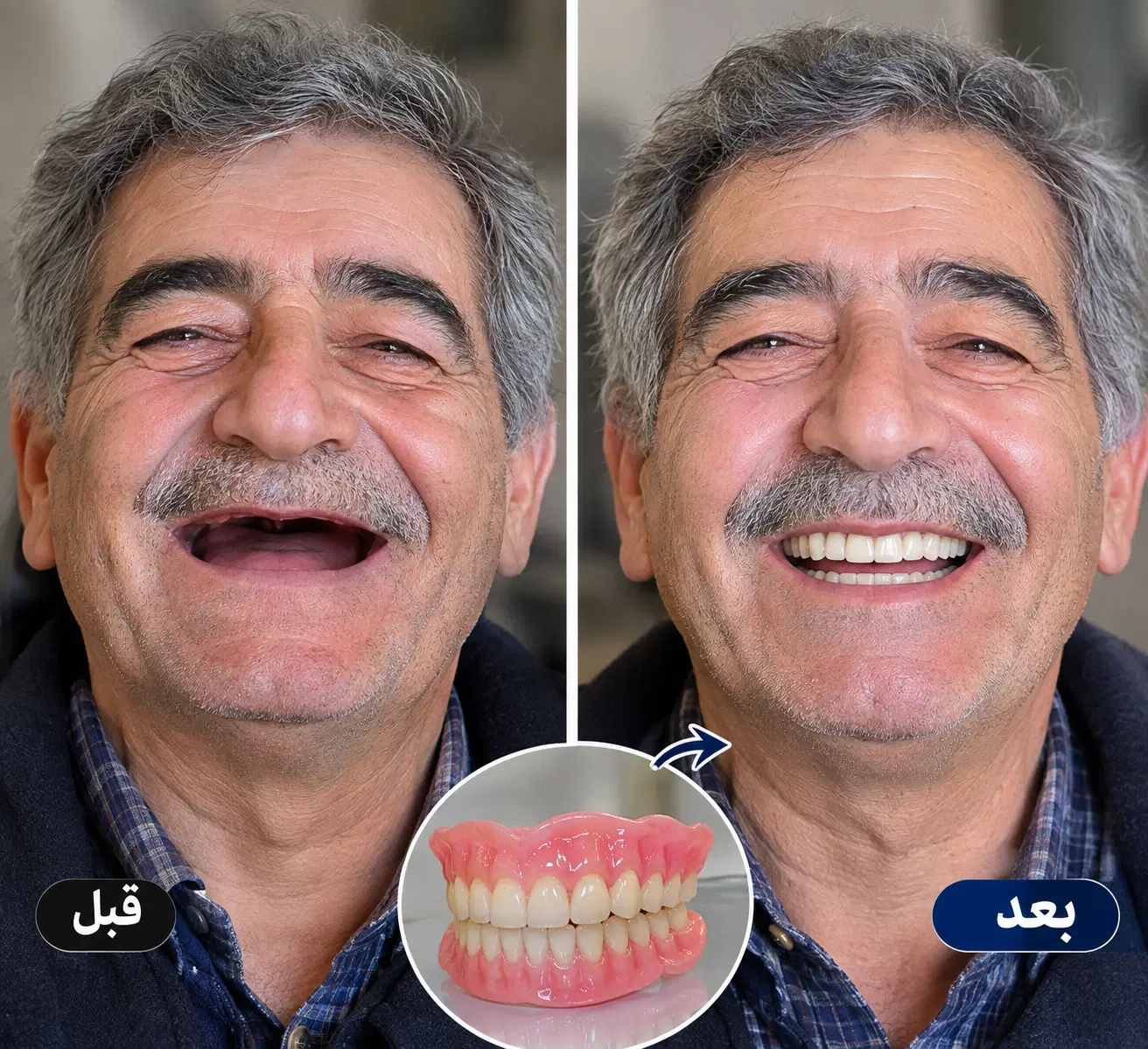 دندان مصنوعی، دست دندان،تعمیرات،دندانسازی|خدمات زیبایی و سلامت|تهران, هاشمآباد|دیوار