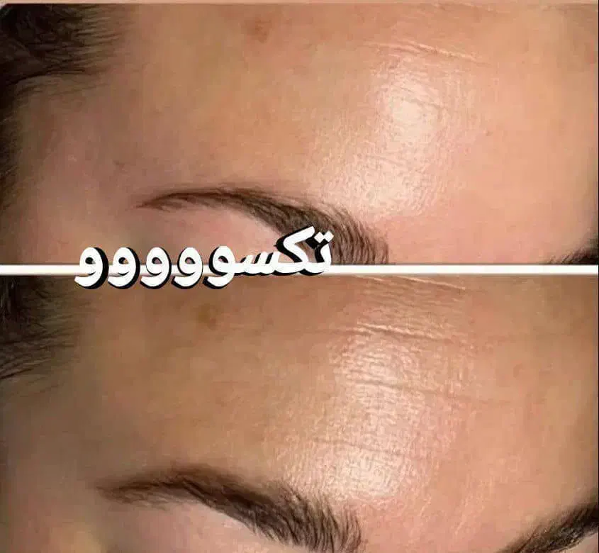 چین چروک تکسوو|آرایشی، بهداشتی، درمانی|شیراز, شاهچراغ|دیوار