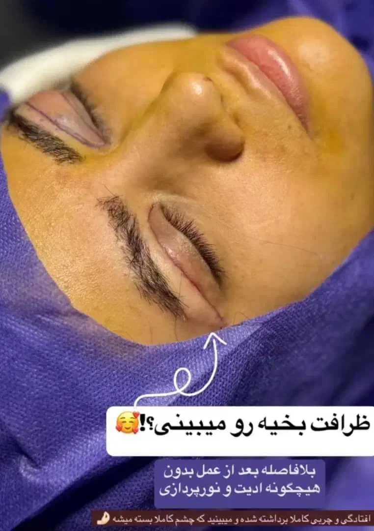 کلینیک زیبایی|خدمات آرایشگری و زیبایی|شیراز, فضل‌آباد|دیوار