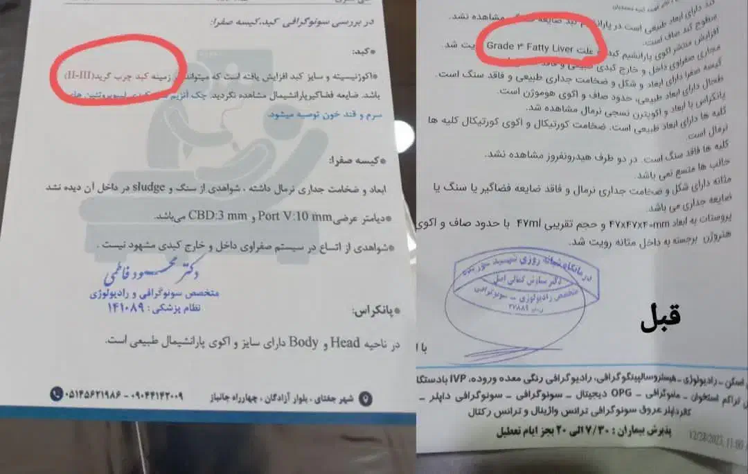 کبد چرب، تناسب اندام ،|تجهیزات ورزشی|خلخال, |دیوار