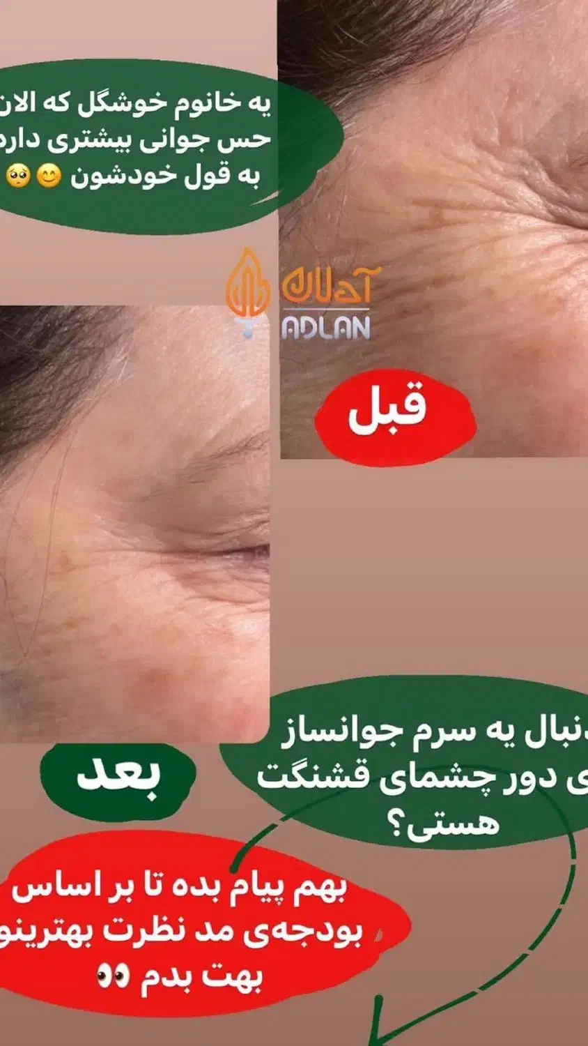 پکیج درمان لک ویژه|آرایشی، بهداشتی، درمانی|تهران, فردوسی|دیوار