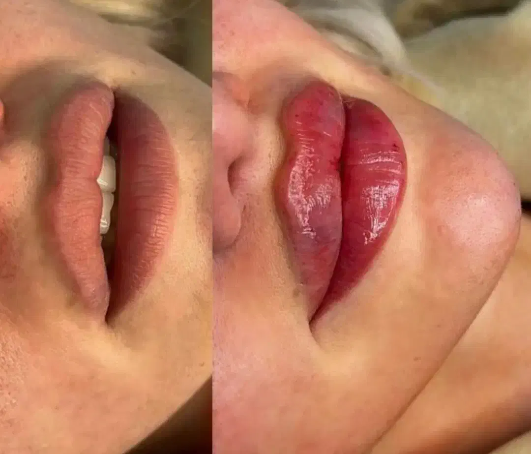 جشنواره ژل و بوتاکس|خدمات آرایشگری و زیبایی|کاشان, کشاورز|دیوار