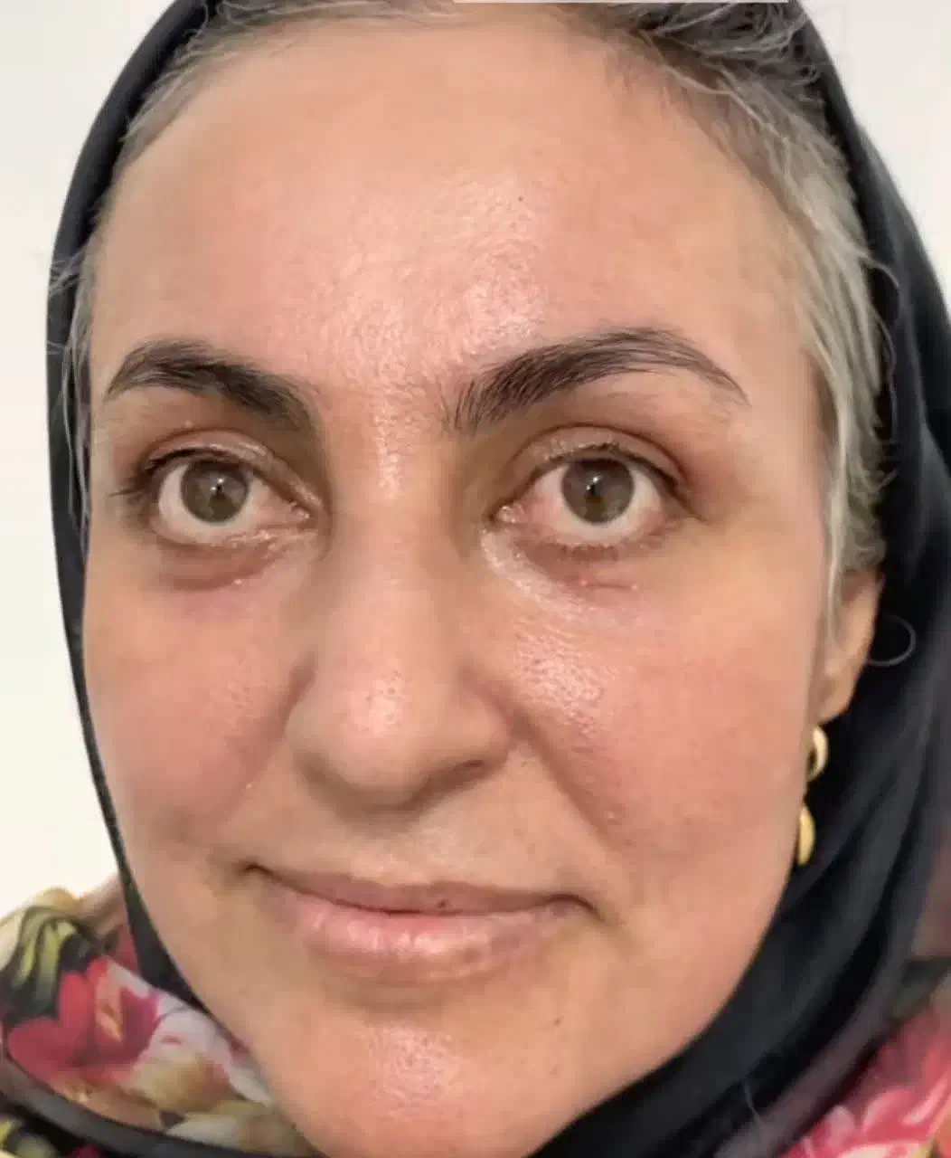 فروش کرم های ضد لک|آرایشی، بهداشتی، درمانی|قائمشهر, |دیوار