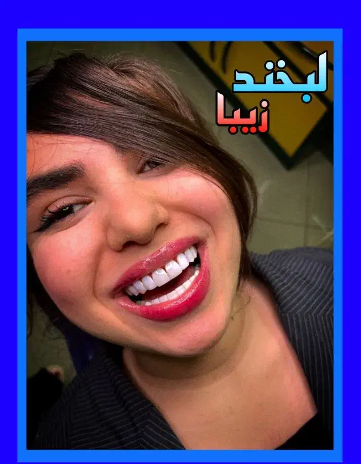 دندانپزشکی/کامپوزیت/ترمیم/عصبکشی ایمپلنت شرق و غرب|خدمات زیبایی و سلامت|تهران, تهرانپارس شرقی|دیوار